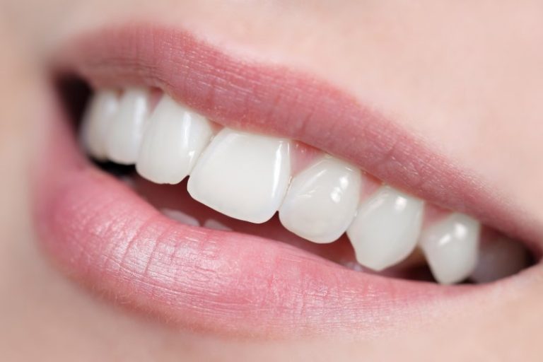 Making Smiles Shine: 4 Great Ways to Get Whiter Teeth